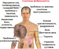 Simptomy-fibromialgii-768x643.jpg